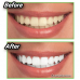LICHIDARE STOC :Miracle Teeth - carbune pentru albirea dintilor